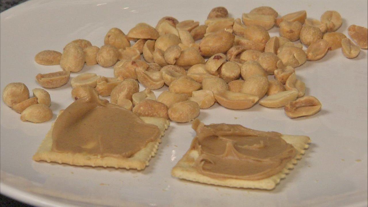 Peanut allergy skin patch could help kids study says